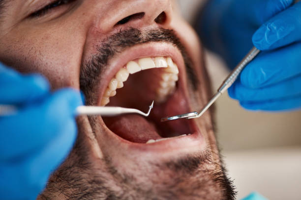 Best Knocked-Out Tooth Emergency  in Lewistown, IL