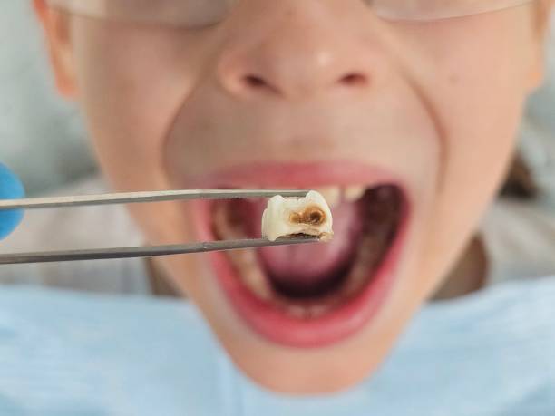 Best Tooth Pain Emergency Relief  in Lewistown, IL